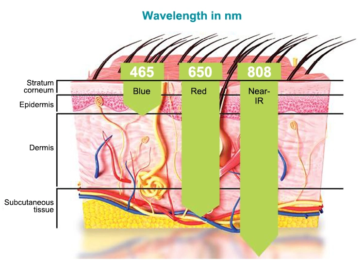 Infrared Light Therapy Cold Laser Therapy Device for Pain Relief